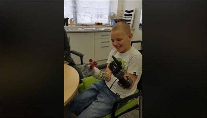 11-year-old becomes youngest boy in the world to have two prosthetic hands