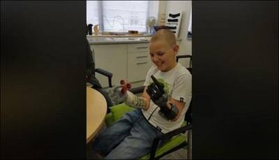 11-year-old becomes youngest boy in the world to have two prosthetic hands