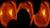 Hinode satellite mesmerises people with dazzling images, video of solar eclipse 