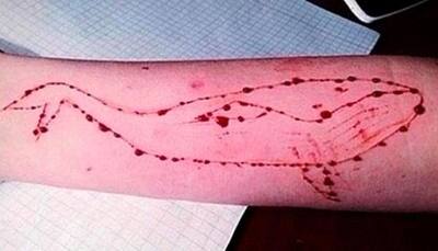 Blue Whale horror strikes again! Rescued Jodhpur girl attempts suicide again by consuming sleeping pills