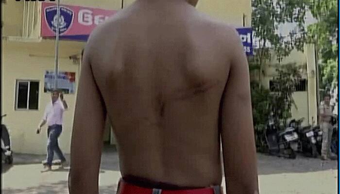 Eight-yr-old mercilessly thrashed by school teacher in Gujarat&#039;s Surat