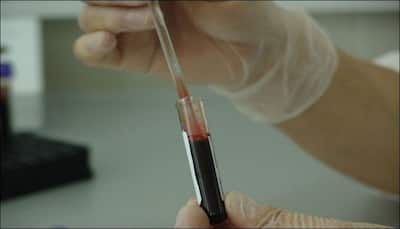 Now, a blood test that can detect a heart attack 'instantly'