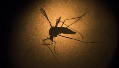 Scientists reveal why Zika virus causes microcephaly