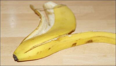 You'll think twice before throwing away that banana peel – Here are some health benefits