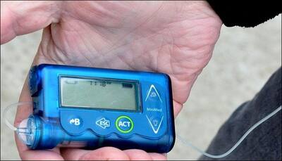 Diabetic kids should use insulin pumps instead of injections: Experts