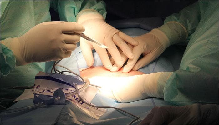 Tumour weighing 3 kilograms removed from 22-year-old&#039;s ovary