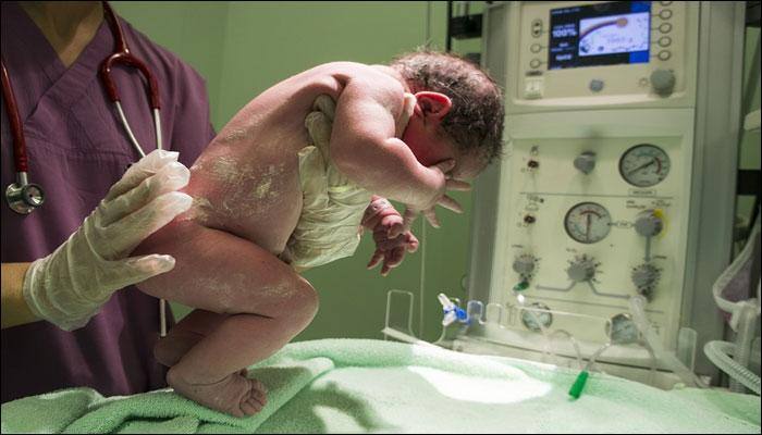 &#039;Vaginal seeding&#039; an unsafe practice, may harm newborn: Doctors