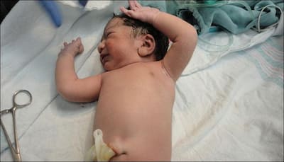 Delaying umbilical cord clamping can prevent deaths of premature babies: Study