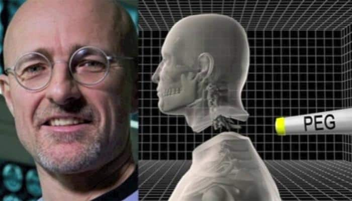 World&#039;s first successful head transplant carried out on corpses, claims scientist