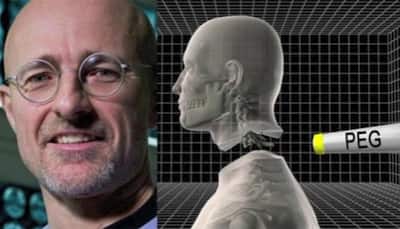 World's first successful head transplant carried out on corpses, claims scientist