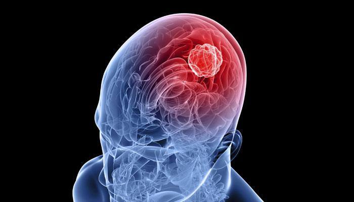 28-year-old brain dead man gives life to three