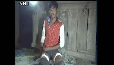 Kanpur: Student wears denim in class, school staff injures legs with scissors