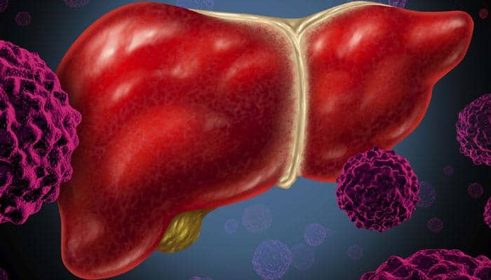 Blood test may prevent liver damage due to paracetamol overdose