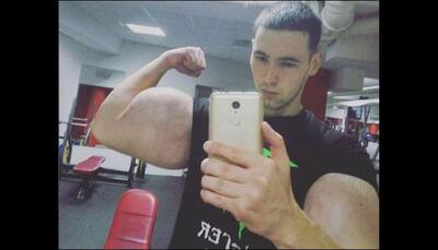 21-year-old has 24-inch biceps after injecting himself with chemical - See pics