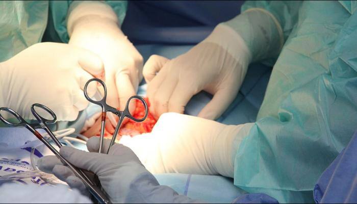 World&#039;s largest reported cyst removed from 5-year-old girl in Jaipur