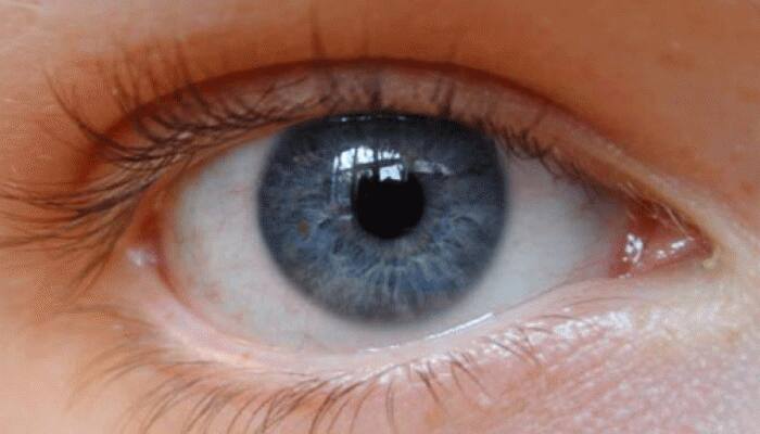 Scientists just developed a gel to treat eye injuries