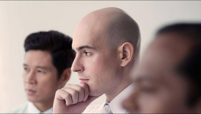 Study associates premature baldness with increased heart disease risk in men