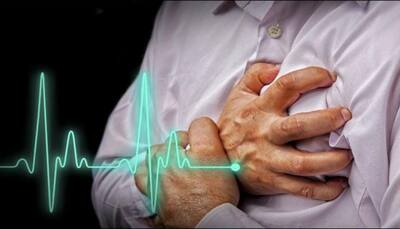 50 percent individuals aged 40-54 have clogged arteries: Study