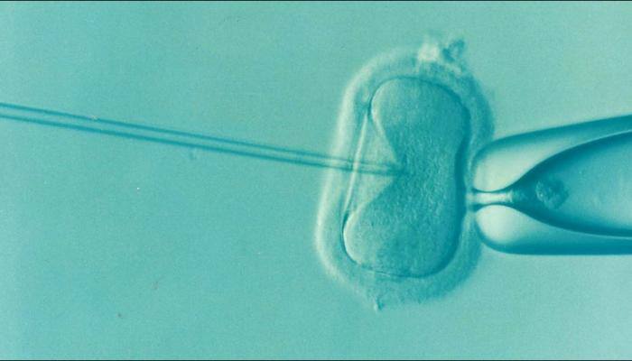 Novel sperm-sorting device could improve IVF success