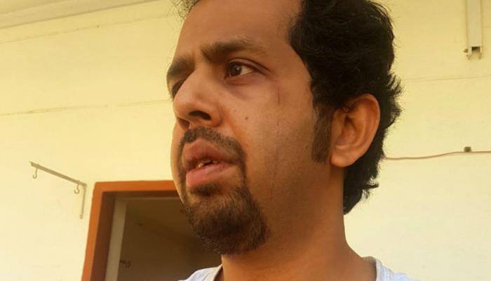 Taha Siddiqui, WION Pakistan bureau chief, survives abduction attempt