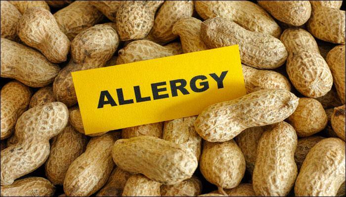 Parents of kids with food allergies aren't very careful: Survey