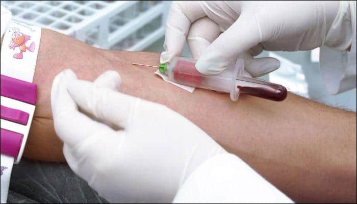 Novel blood test may help you measure your heart health