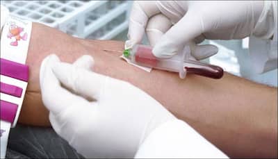 Novel blood test may help you measure your heart health