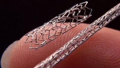 New price cap on stents limits margins to 8 percent; DES price comes down to Rs 28,000