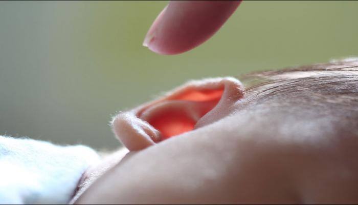 Heart surgery in infants may cause deafness