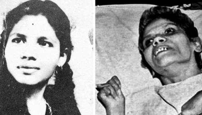How sexual assault victim Aruna Shanbaug's case started the national debate on euthanasia