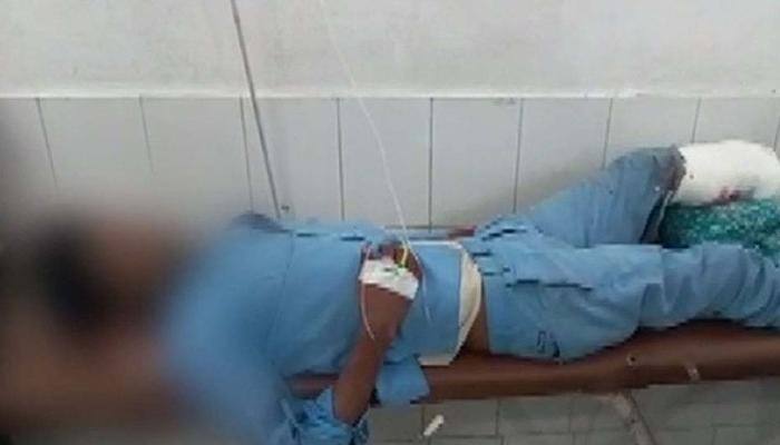 Two doctors suspended after accident victim&#039;s amputated leg used as pillow at Jhansi hospital