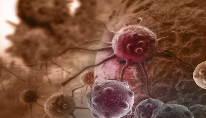 Socio-economic status may affect patients with anal cancer