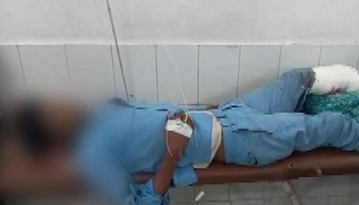 Amputated leg used as pillow: NHRC issues notice to Yogi Adityanath government