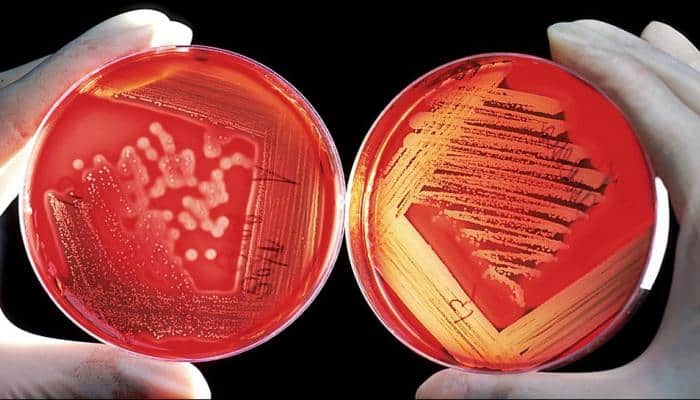 'Disease X' added to list of potential pandemic killers by WHO