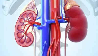 Experimental obesity drug may prevent kidney stones
