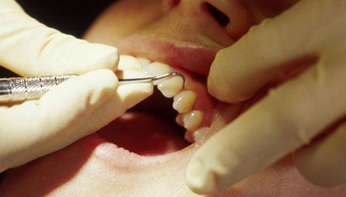 Study associates poor dental health to diabetes risk