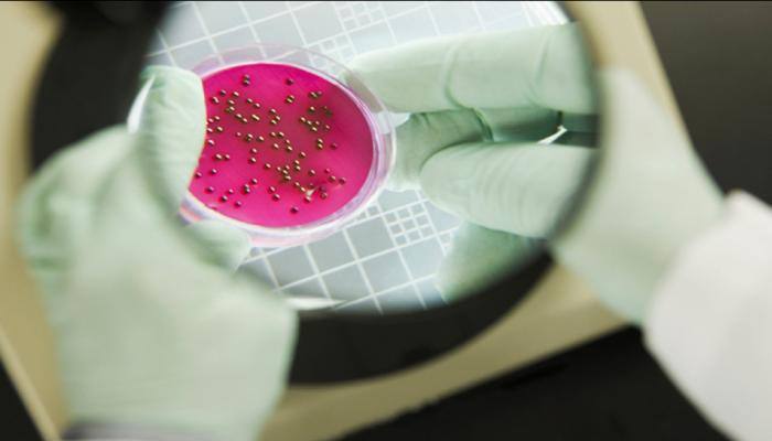UK man caught with world's 'worst-ever' case of super-gonorrhoea. What is super-gonorrhoea?