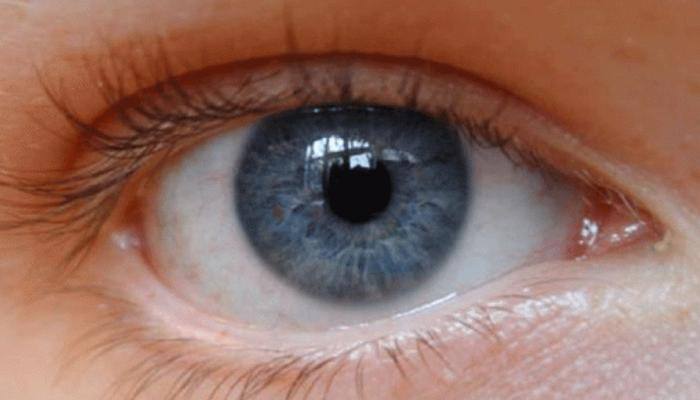 US FDA approves first AI device to detect diabetic eye disease
