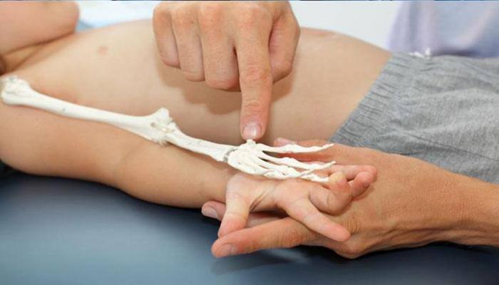 Mystery behind rare bone disorder cracked