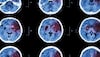 How office colleagues helped save brain stroke patient
