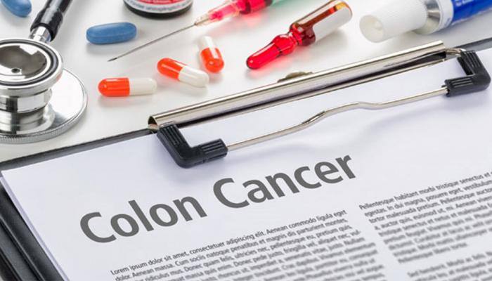 Even low doses of certain iron supplements can develop colon cancer 