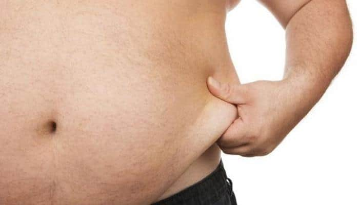 Obesity raises risk of irregular heart rate