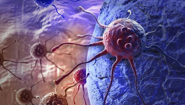 A New subtype of prostate cancer identified