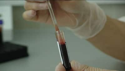 Simple blood test can tell if you're sticking to diet: Scientists