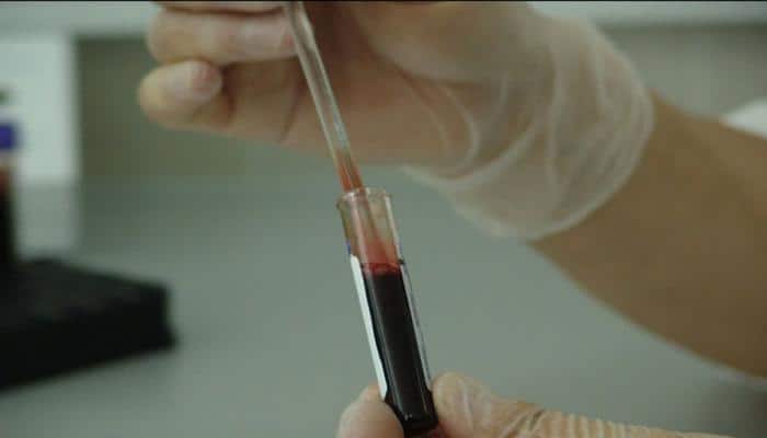 Simple blood test can tell if you're sticking to diet: Scientists