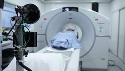 CT scans may increase brain cancer risk