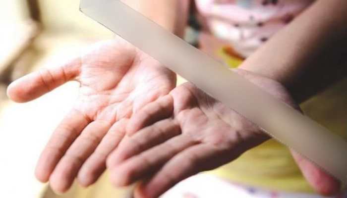 Angry over bed-wetting, step-mother brands 7-year-old girl with hot spatula