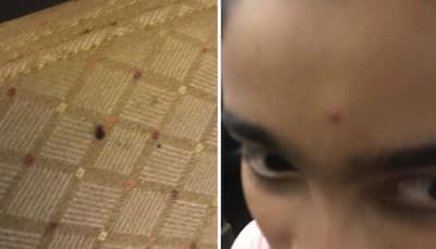 Passengers post photos of bed bugs on Air India flight from the US, airline calls it an 'isolated' case