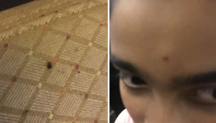 Passengers post photos of bed bugs on Air India flight from the US, airline calls it an 'isolated' case