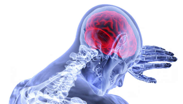 Know the potential biomarkers of cerebral aneurysm risk